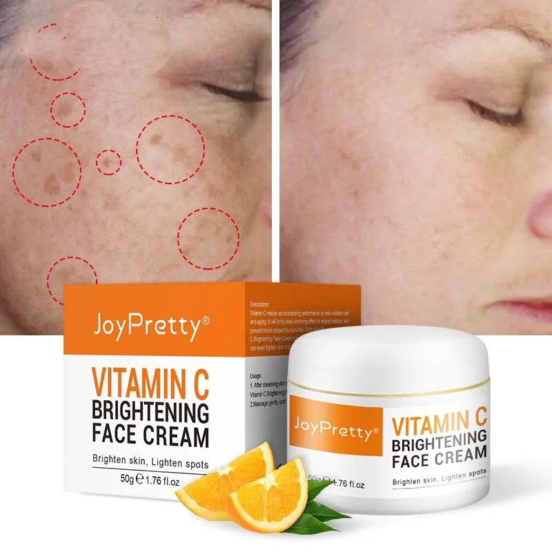 

Joypretty Vitamin C Whitening Face Cream Dark Spots Facial Cream Repair Fade Freckls Melanin Remover Brightening Skin Face Care