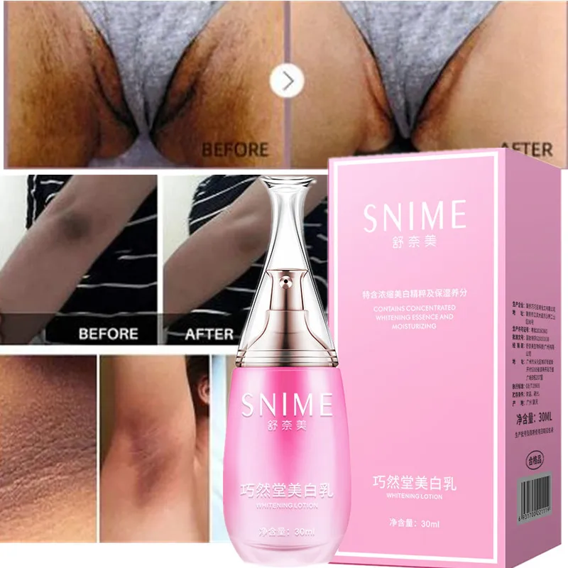 

30Ml Concealer Body Whitening Cream Dark Spots Whitening Black Joints Knees Ankles Brightening Armpit Privates Whitening Cream