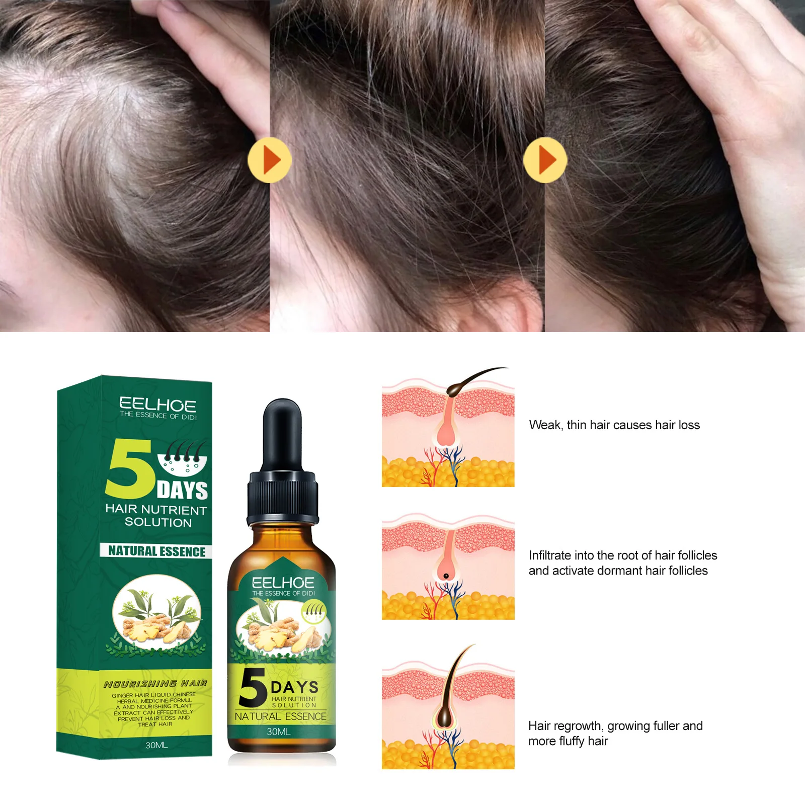 

7 Days Ginger Hair Care Essential Oil Hair Growth Natural Solution Anti Hair Fall Oil Treatment Serum Essence Hair Care 30ml
