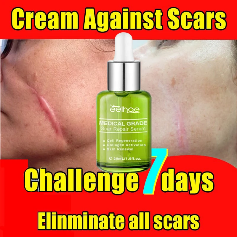 

7 Days Fast Scar Removal Serum Facial Skin Scars Treatment Surgical Burn Scars Stretch Marks Acne Pox Prints Repairing Skin Care