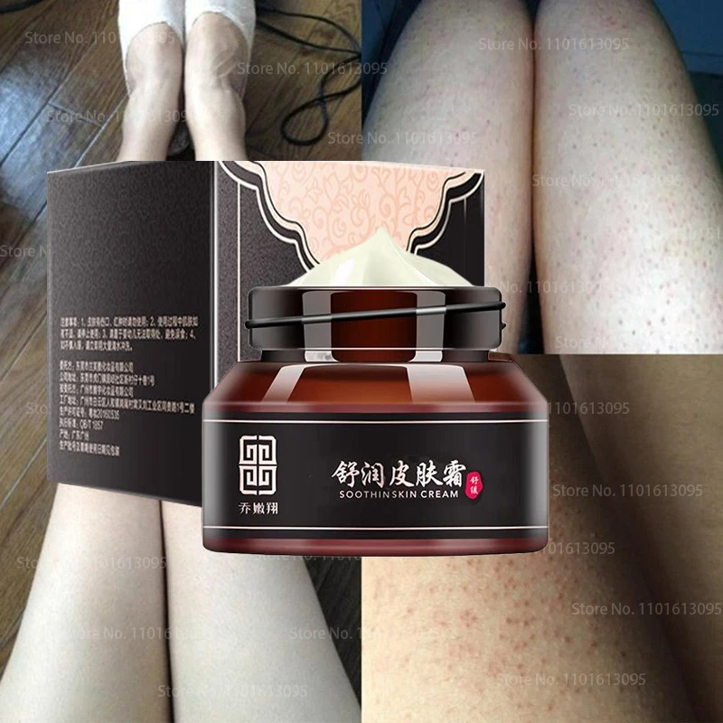 

30g /ml Curing Keratosis Pilaris Kp Chicken Skin Repair Cream Body Lotion Skin Skin Care Essence Moisturizing and Nourishing