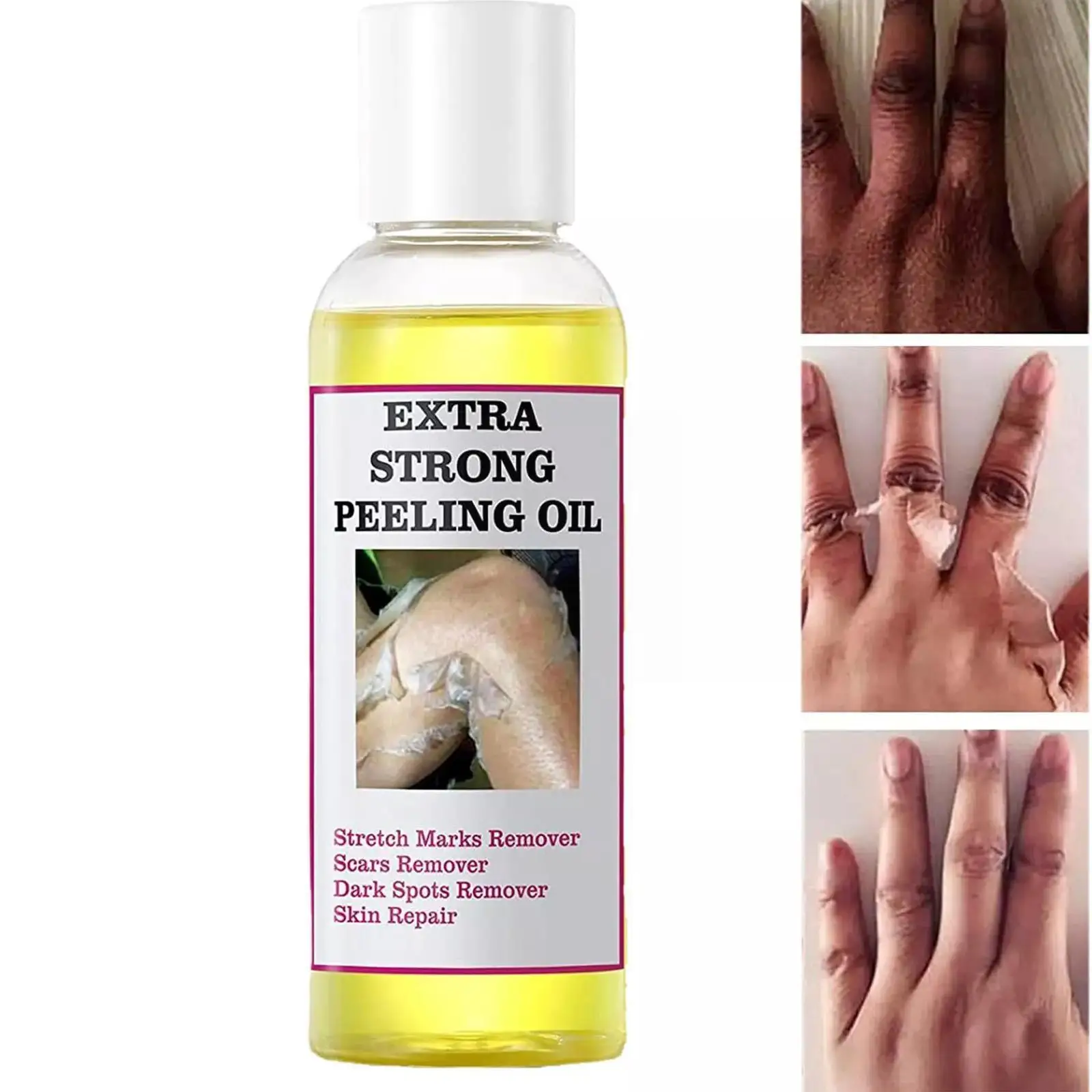 

110mL Peeling Oil For Dark Skin Super Strength Yellow Peeling Oil Strong Peeling Oil For Skin Brightening Moisturizing Removes