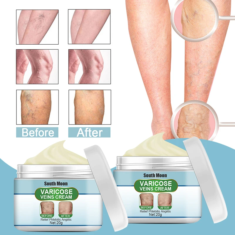 Крем для варикозного расширения вен 20 г |