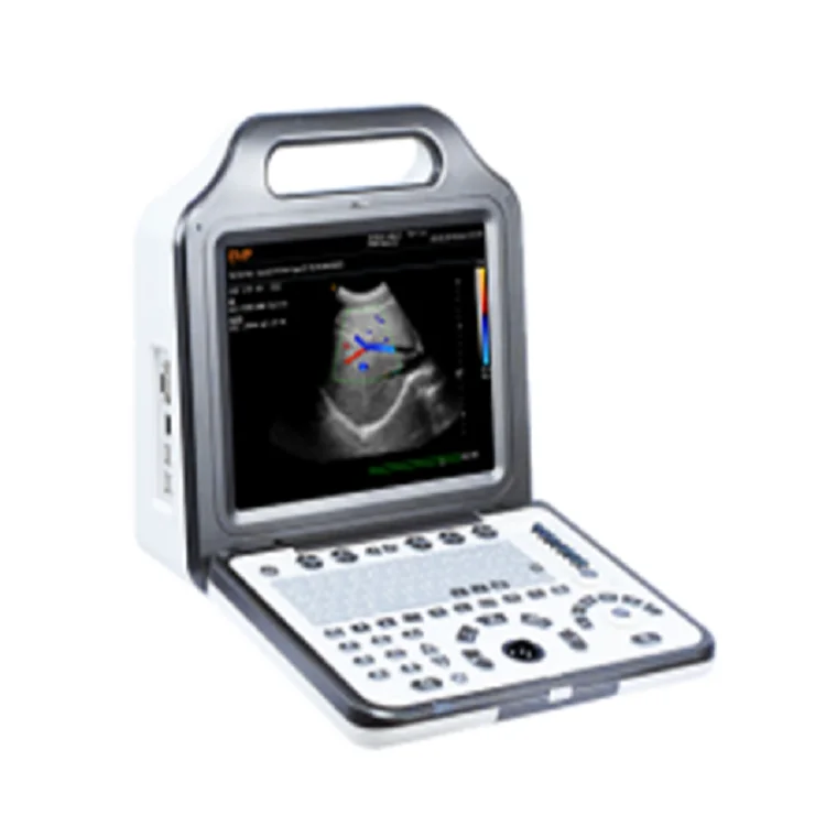 Карманный Ультразвуковой портативный