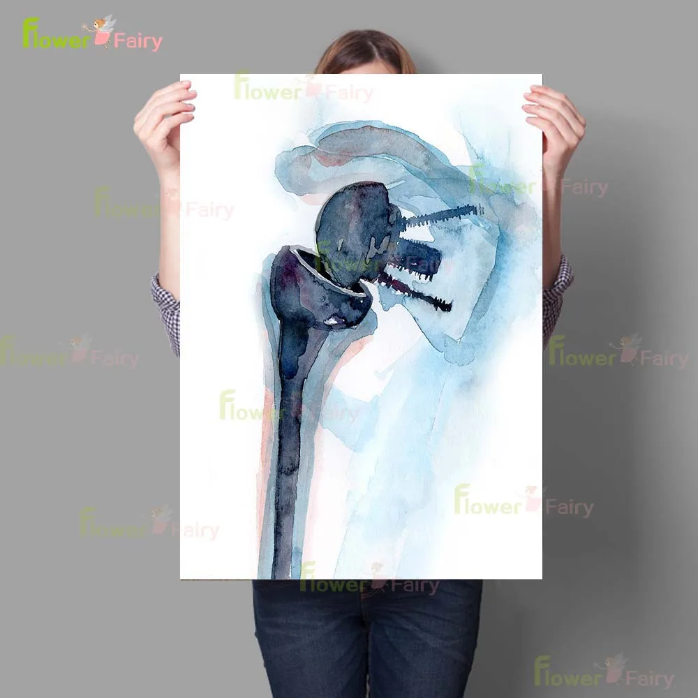 

Настенная картина "Ортопедическая хирургия костного мозга"