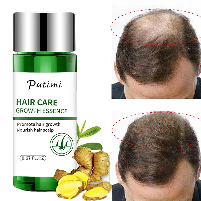 

Hair Growth Essential Oil Essence Anti Hair Loss Treatment Products Fast Grow Repair Scalp Prevent Dry Frizzy Nourish Hair Roots