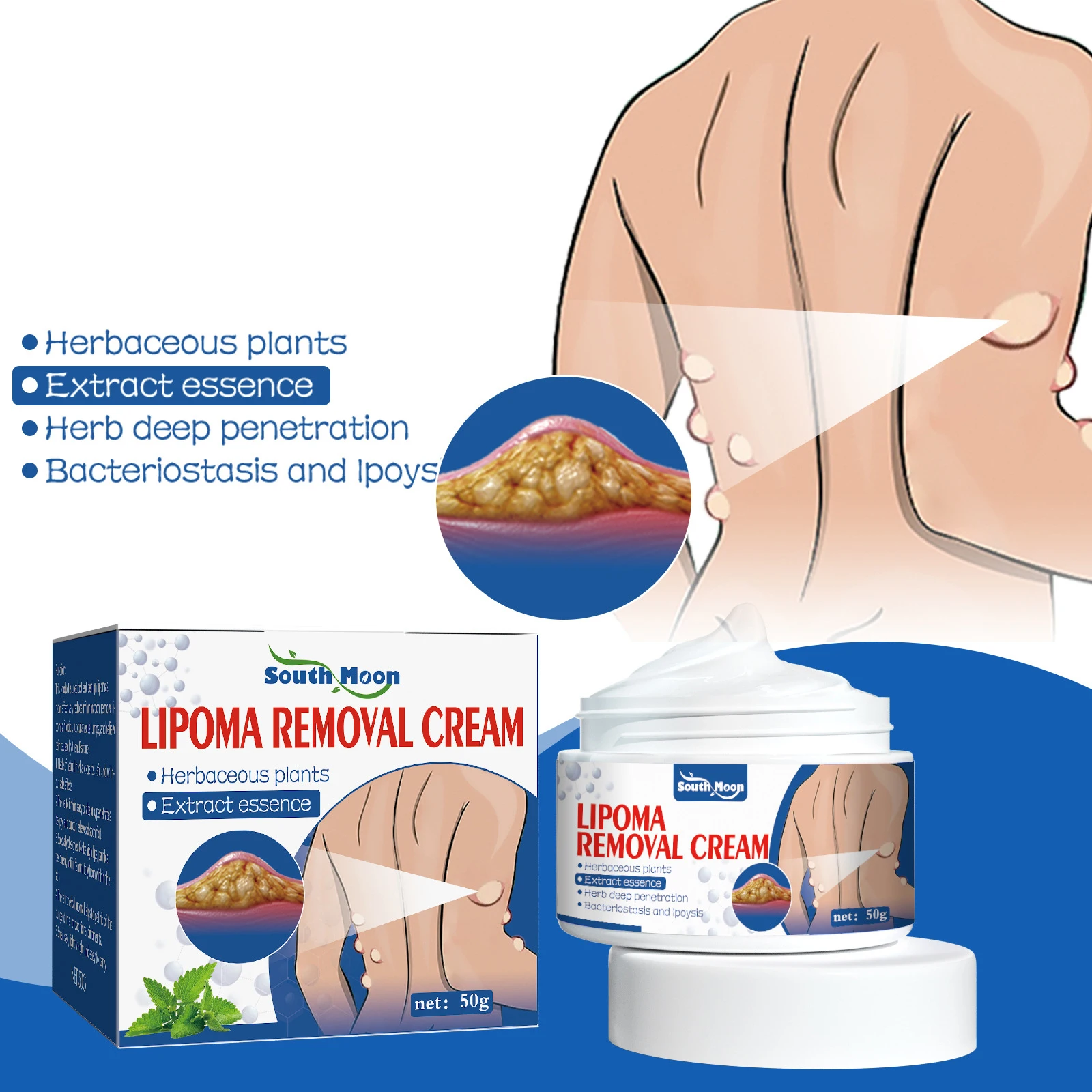 

10pcs Lipoma Removal Cream Treat Skin Swelling Tumor Relief Removes Subcutaneous Lipoma Lumps 50g