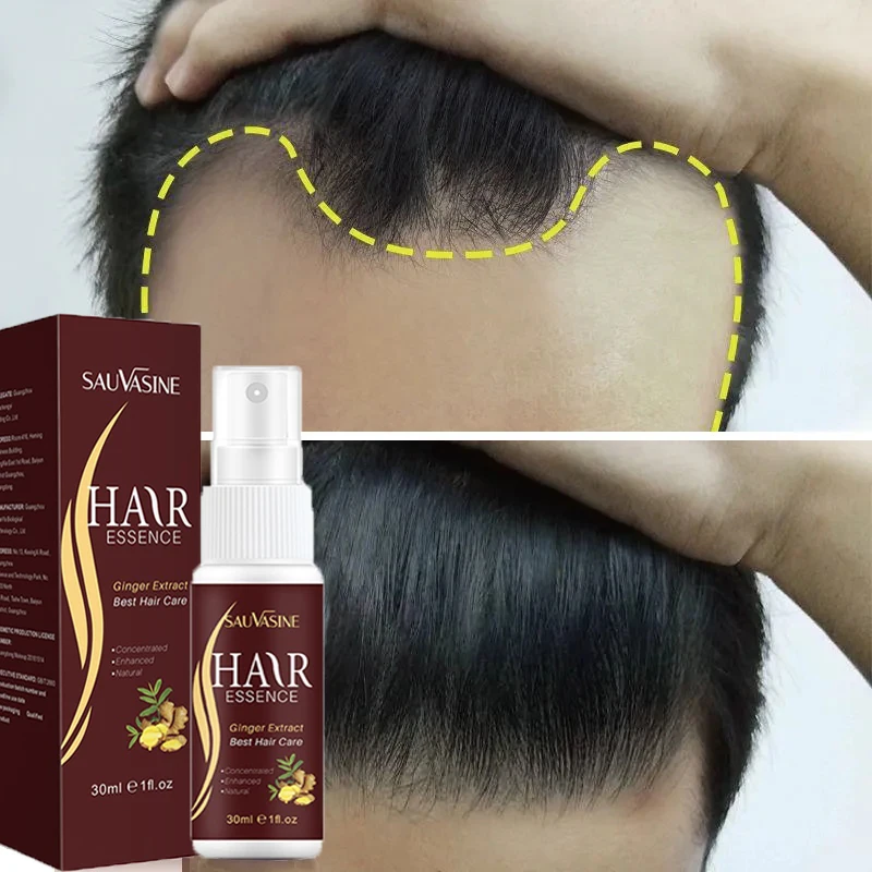 

Powerful Hair Growth Serum Spray Hair Loss Treatment Preventing Loss Repair Scalp Fast Growing Essence Sprays Hair Care Products