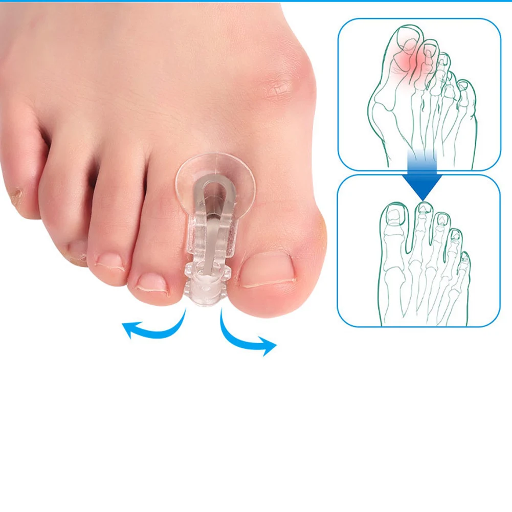 

Ортопедический корректор большого пальца стопы, корректор, выпрямитель для ног