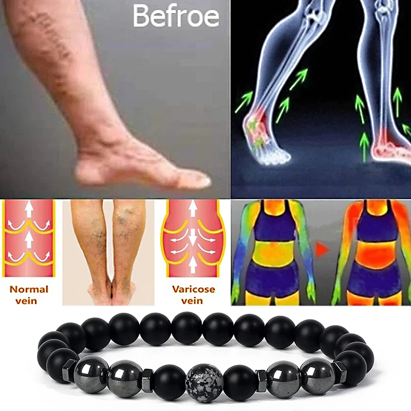 

Magnetic Hematite Bracelets Brazilian Nature Stone Loss Magnetic Therapy Anklet Weight Loss Product Slimming Health Care Jewelry