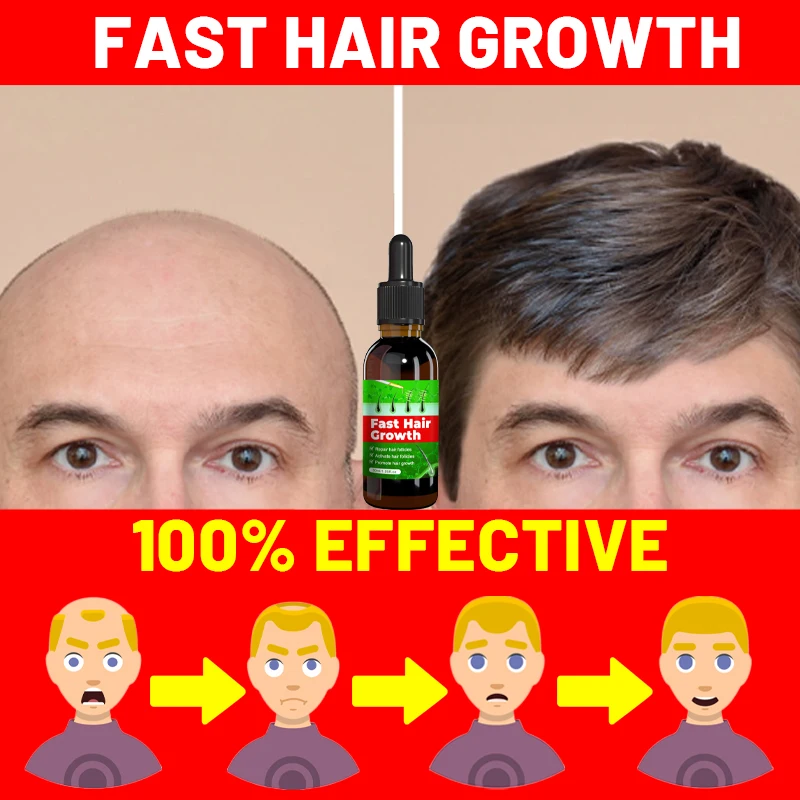 

Fast Hair Growth Hair Growth Oil Effective Baldness Repair Hereditary Hair Loss Postpartum Hair Loss Seborrheic Hair Anti Loss