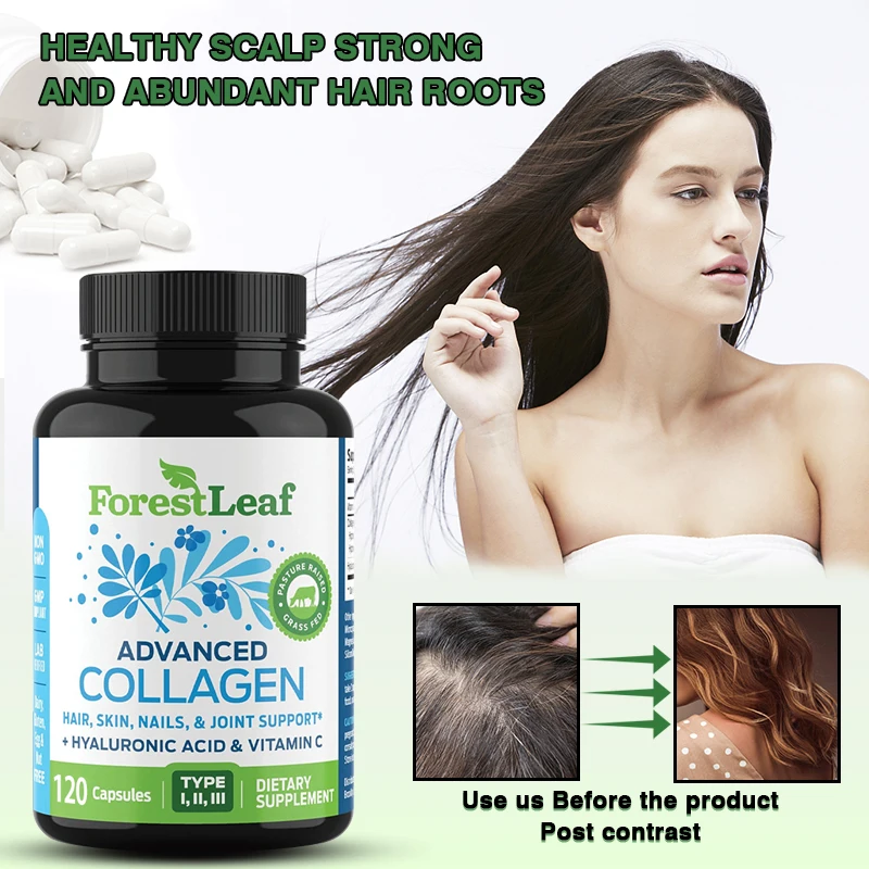 

Гидролизованная коллагеновая Пептидная добавка с витамином C, уменьшает морщины, укрепляет кожу, способствует здоровому росту волос, кожи и суставов