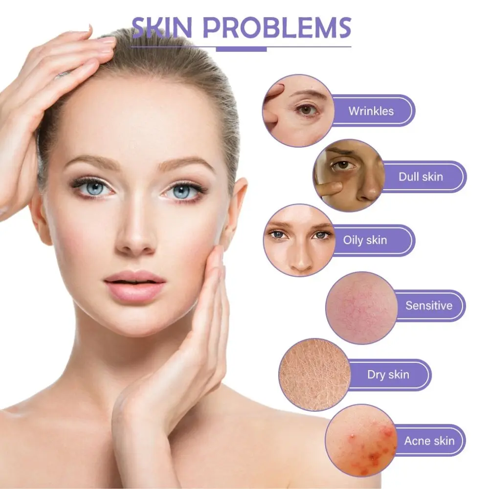 Рисунок 4 - шприцевые иглы для мезотерапии