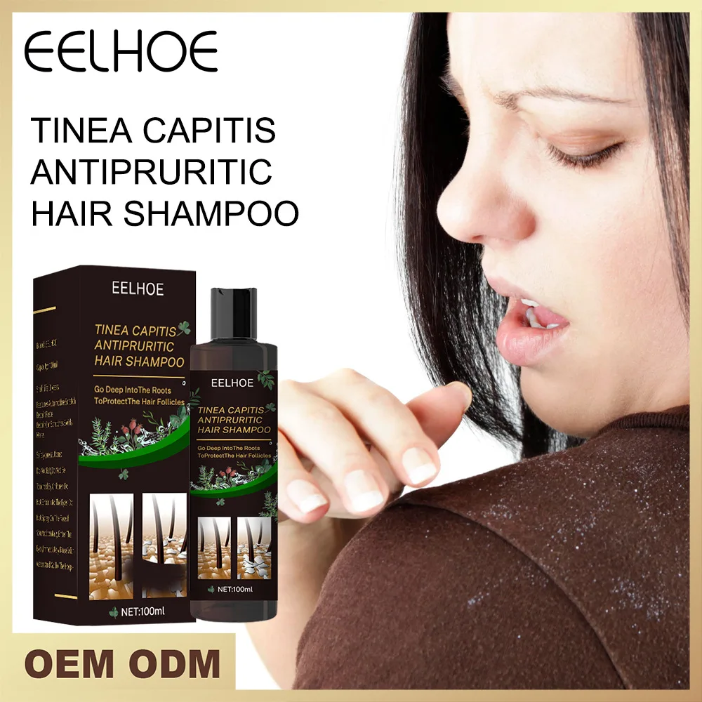 

Anti-Itching Anti-Dandruff Oil-contrl Shampoo