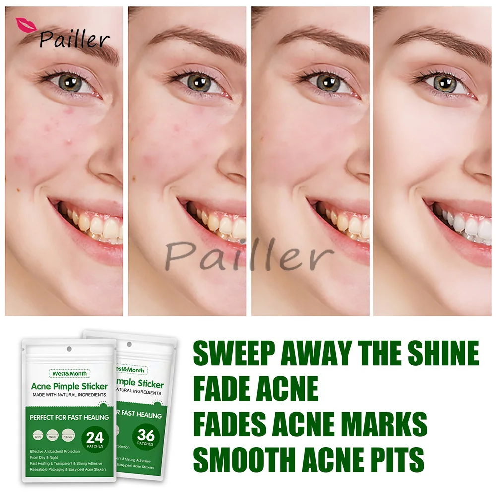 

24pcs Acne Patch Tool Blemish Freckle Mask Dots Acne Pimple Patches Spot & Blemish Treatment Stickers Reduce Skin Inflammation