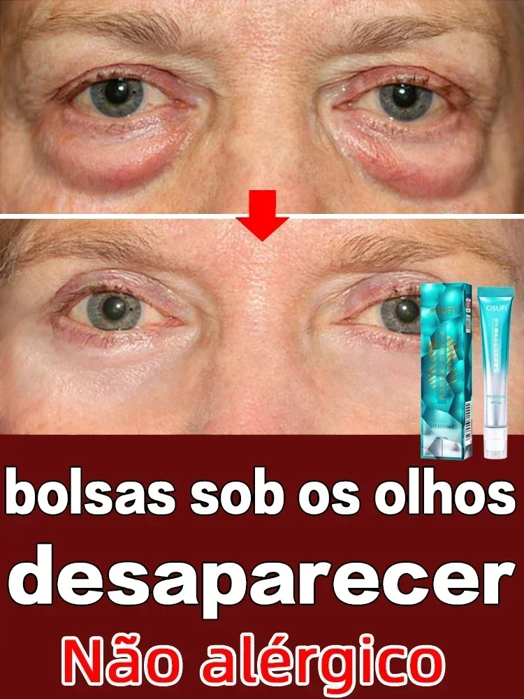 Сыворотка для области вокруг глаз от Тёмных кругов и мешков под глазами