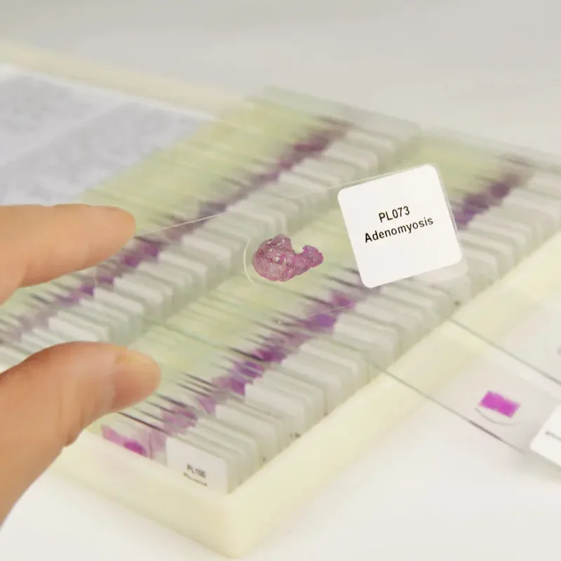 100 видов медицинских патологических секций человеческого тела типовые