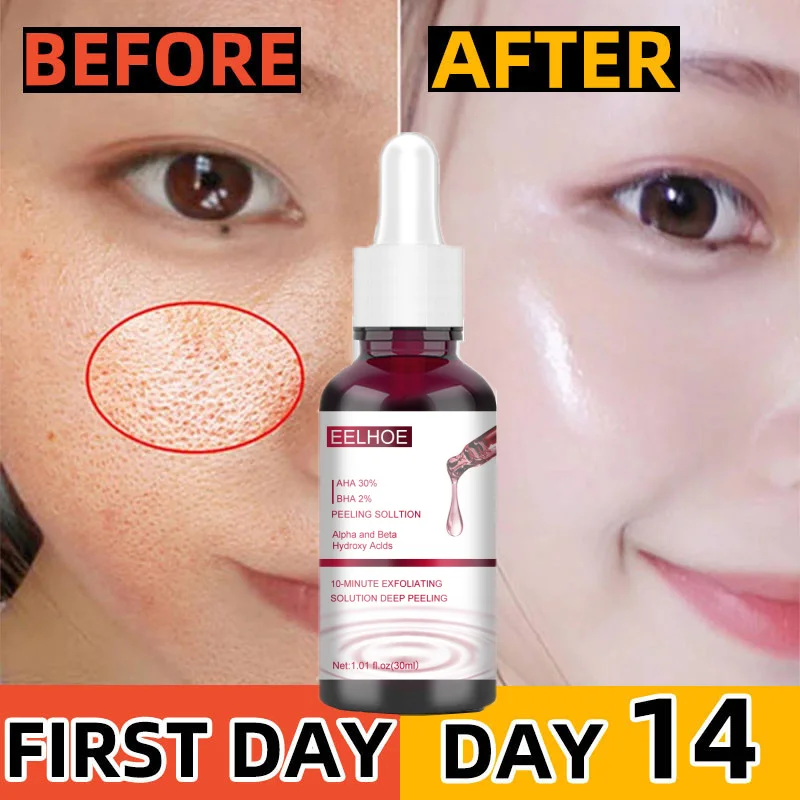 

Pore Shrinking Whiten Face Serum Salicylic Fruit Acid Essence Remove Acne Mark Dark Spots Glowing Skin Moisturize Beauty Product