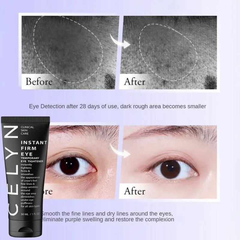 

Eye Cream Eye Firming Eye Lifting Firming Eye Bag Removal Wrinkle Eye Care Temporary Eye Bags Removal Eyes Cream Dark Circles