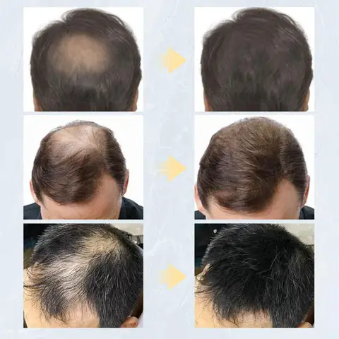 Пудра для роста волос мужская с кератиновым аппликатором, 27,5 г