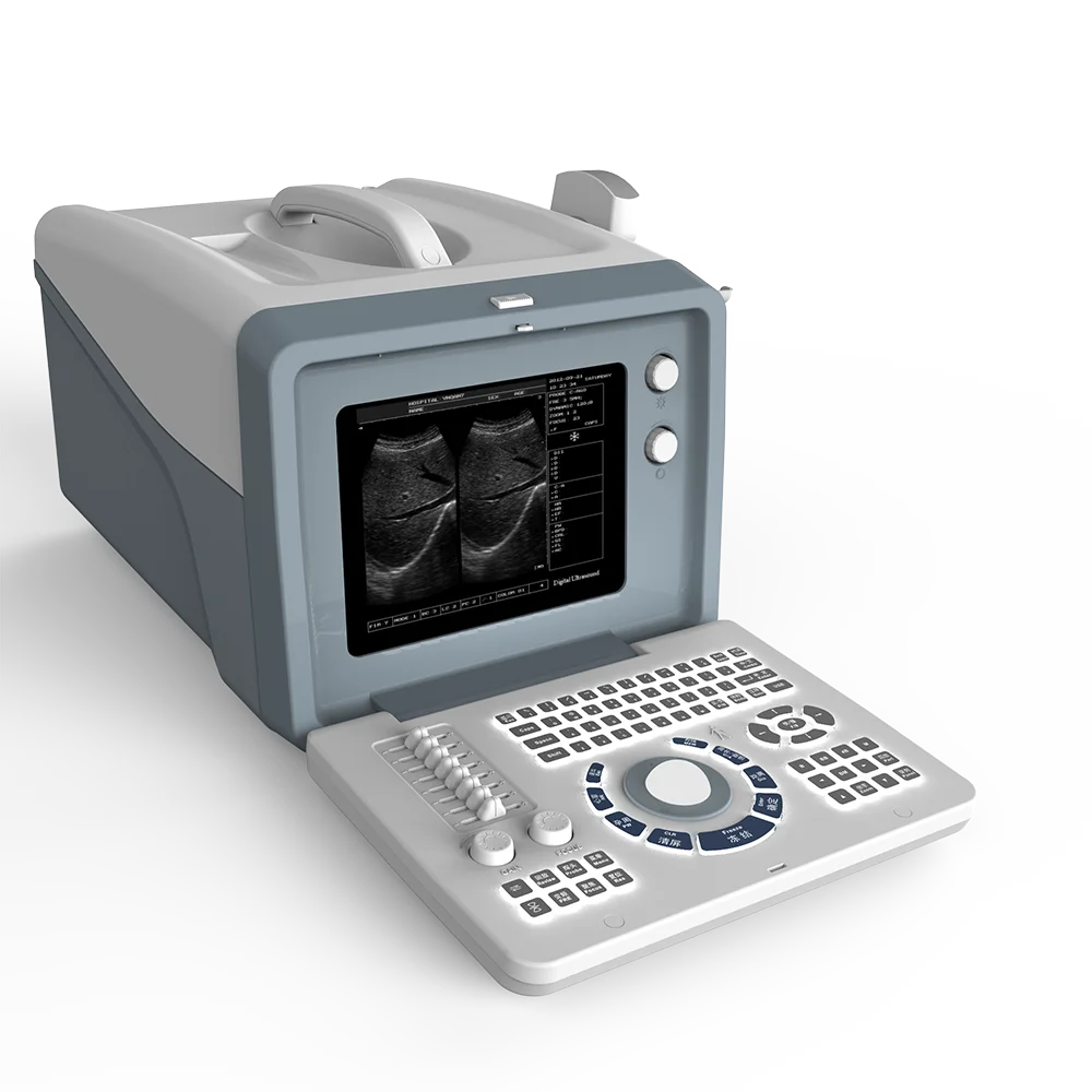 

Handheld High Image Quality Portable Ultrasound Machine