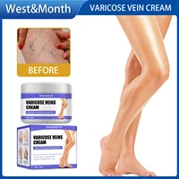 varicose vein cream vasculitis relief phlebitis spider earthworm leg angiitis feet pain relief inflammation hydraing skin care