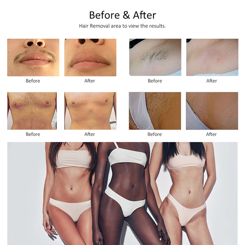 Рисунок 6 - Эпилятор для льда AresMix DL1500