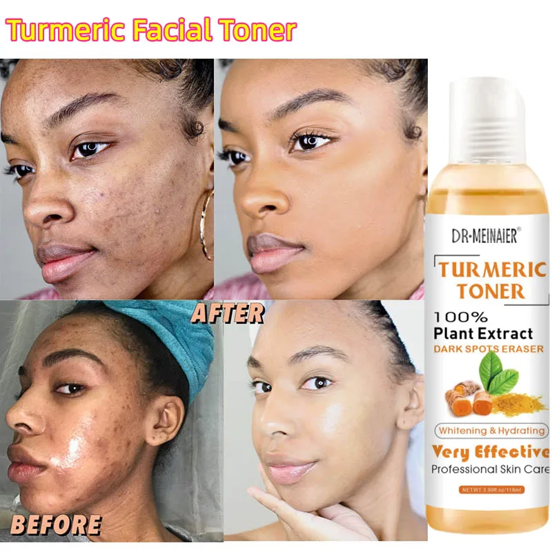 

Turmeric Facial Toner Anti Aging Acne Dark Spot Removal Whitening Face Serum Ginger Moisturizing Skin Brighten Essential Liquid