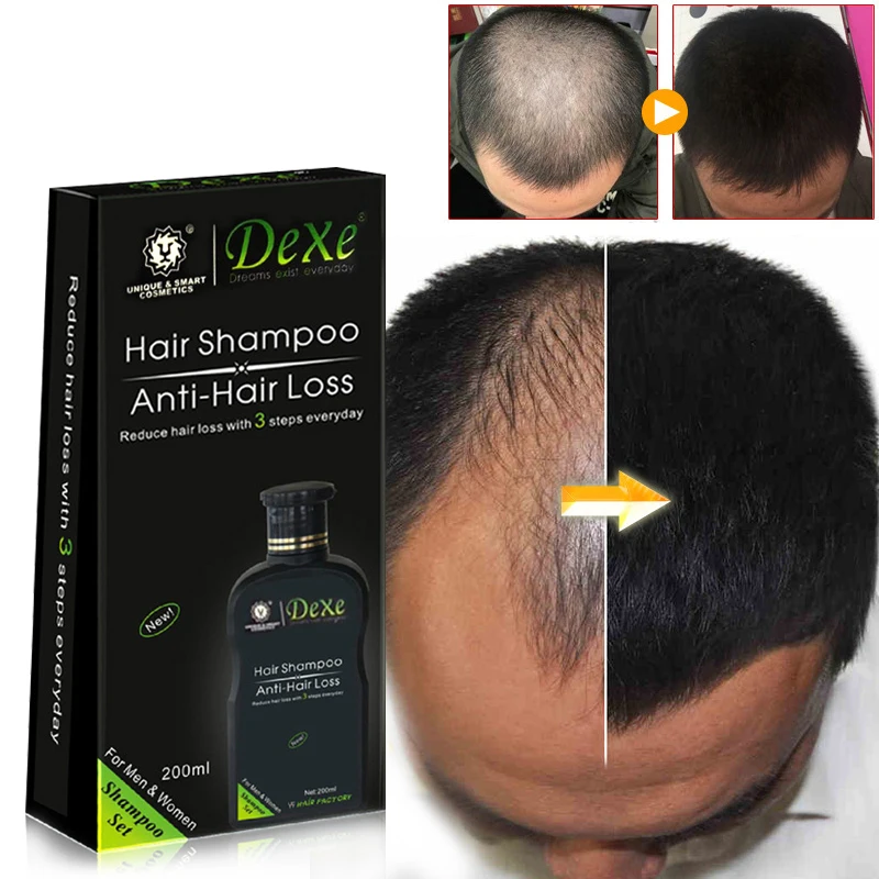 Dexe Professional hair growth Shampoo  Anti-hair Loss Chinese Herbal Hair Growth Product Prevent Hair Treatment for Men & Women