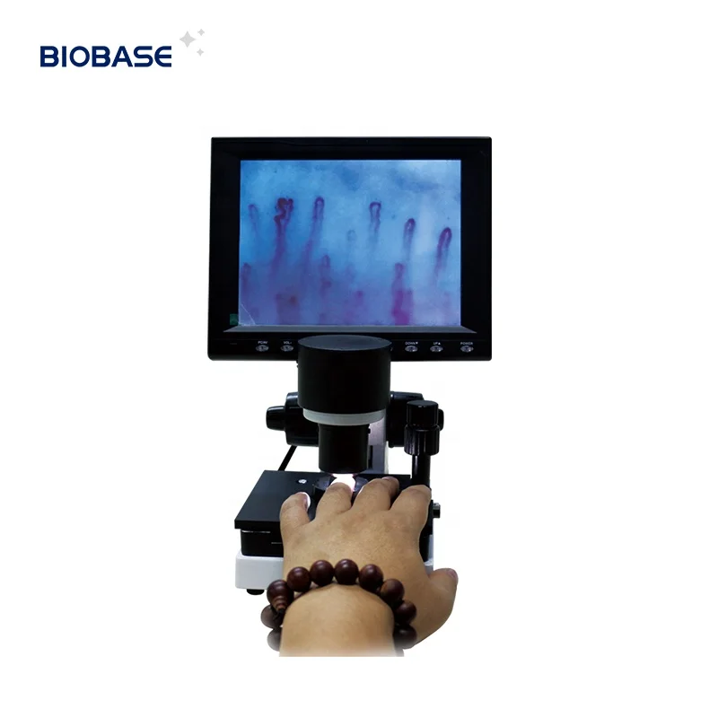 

Микроскоп Biobase с микроциркуляцией, HD ЖК-дисплей, микроскоп для мониторинга микроциркуляции для ранней диагностики