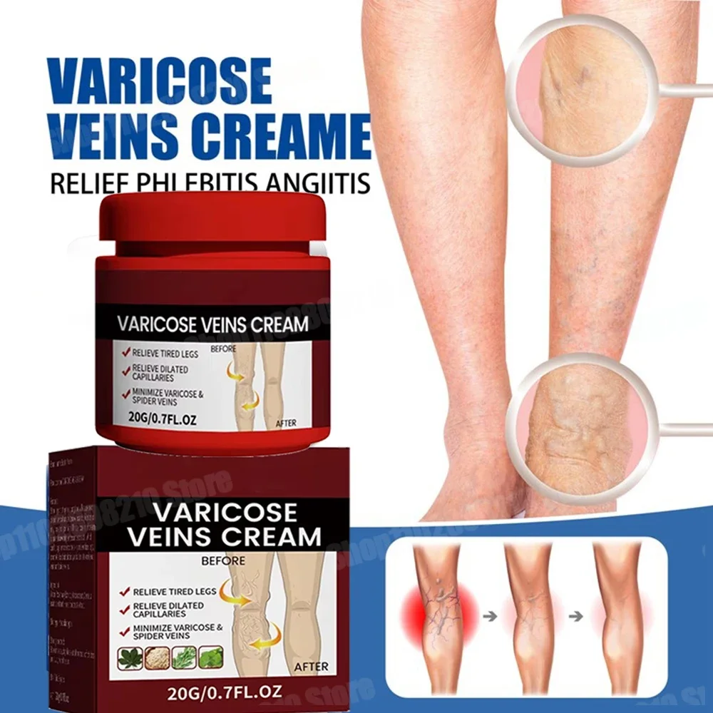 Крем против зуда противозудный псориаз экзема внутренняя часть аллергические