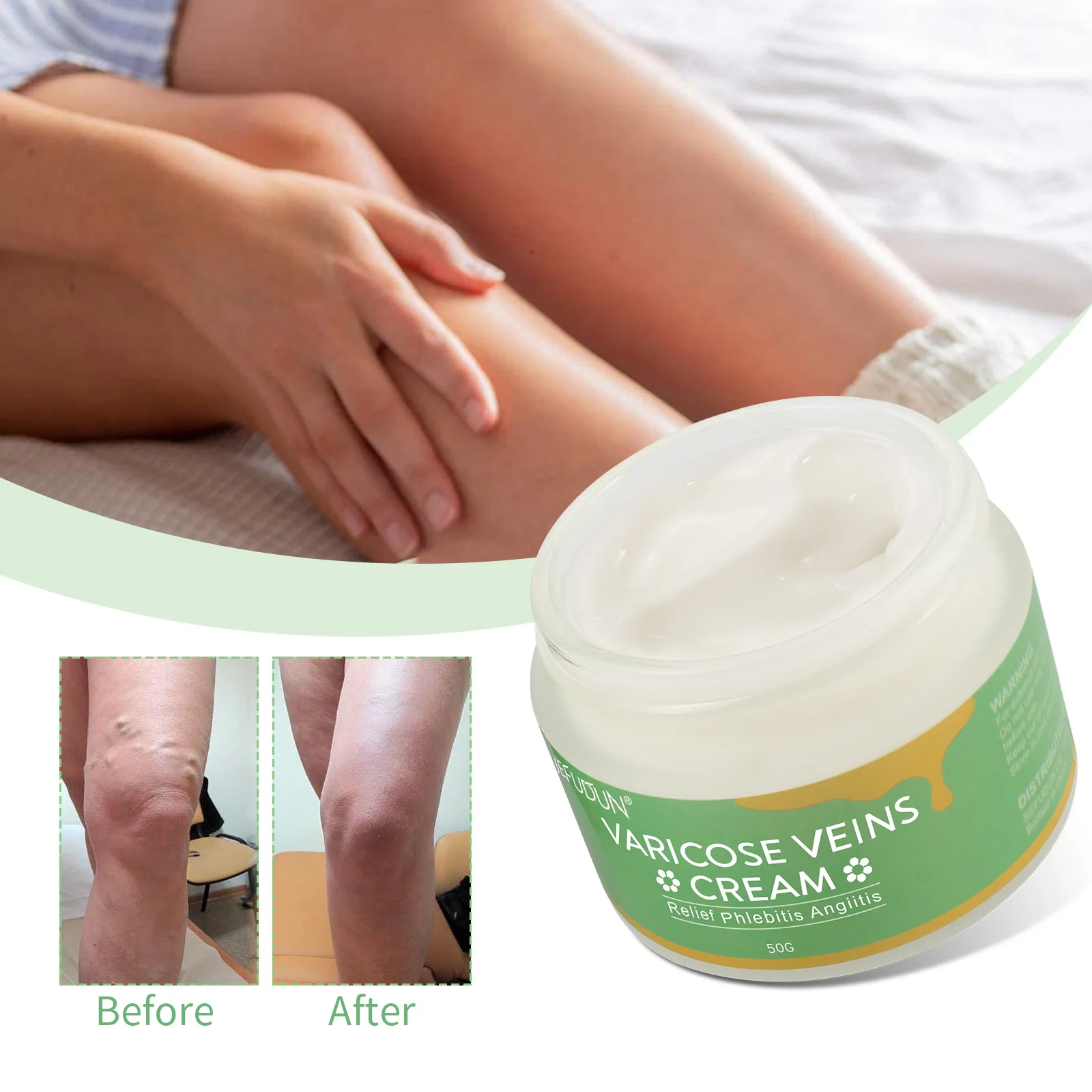 

50gVaricose Veins Cream Varicose Vein Soothing Leg Cream Natural Varicose & Spider Veins Treatment Strengthen Capillary Health