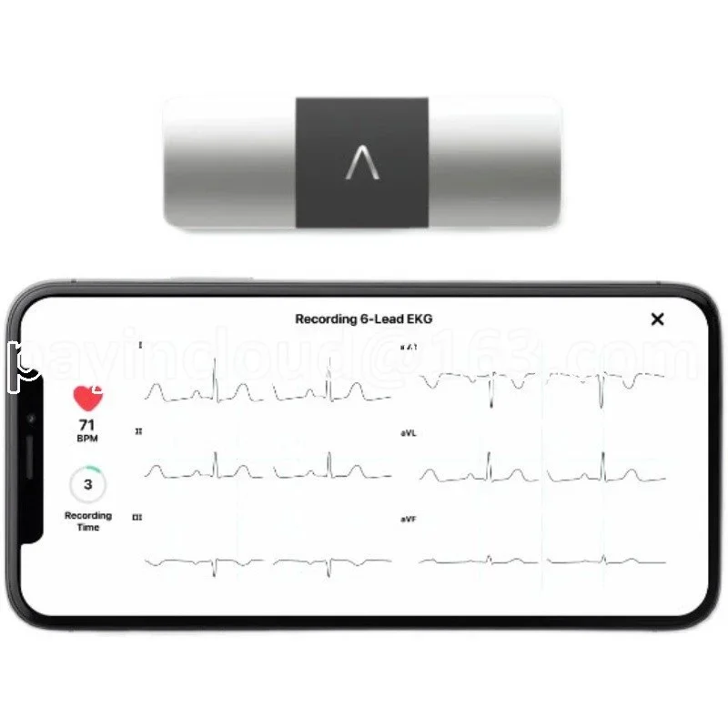 Подходит для AliveCor KardiaMobile 6L интеллектуального портативного оборудования