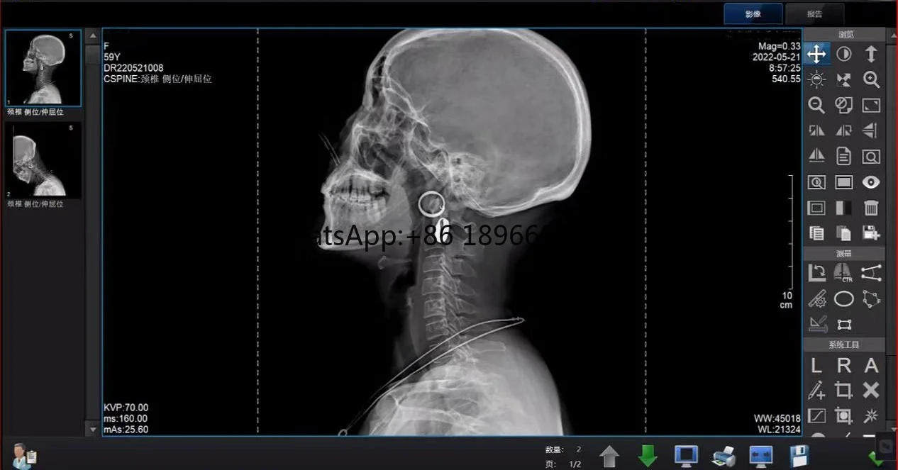 Медицинское рентгенографическое оборудование рентгенологическое провод CSI 17*17 XV