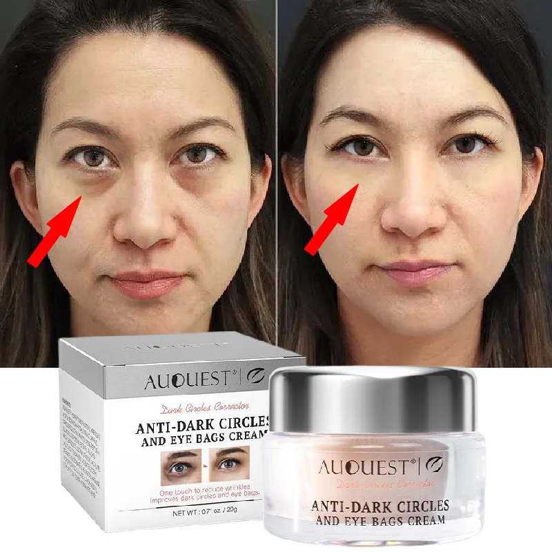 

Anti Dark Circles Eye Cream Fade Fine Lines Remove Eye Bags Puffiness Lighten Pigmentation Moisturizing Nourish Beauty Skin Care