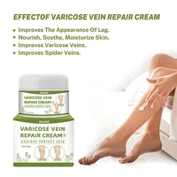 50g varicose vein cream leg swelling nontoxic care cream relieve phlebitis vasculitis ointment body leg treatment cream