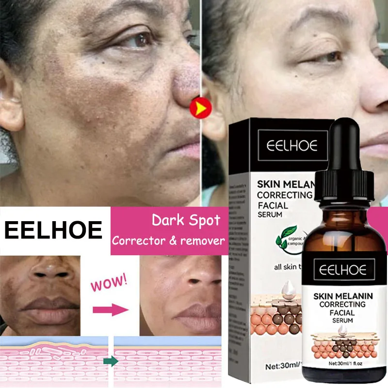 

Whitening Freckle Serum Fade Melasma Dark Spots Remove Pigment Brighten Lighten Melanin Improve Dull Anti-aging Face Skin Care