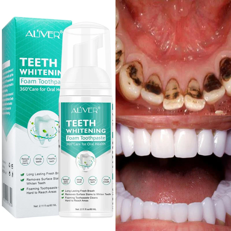 

Teeth Whitening Cleansing Mousse Remove Tooth Stains Fresh Breath Deep Clean Mouth Toothpaste Tooth Bleaching Care Product 60ML