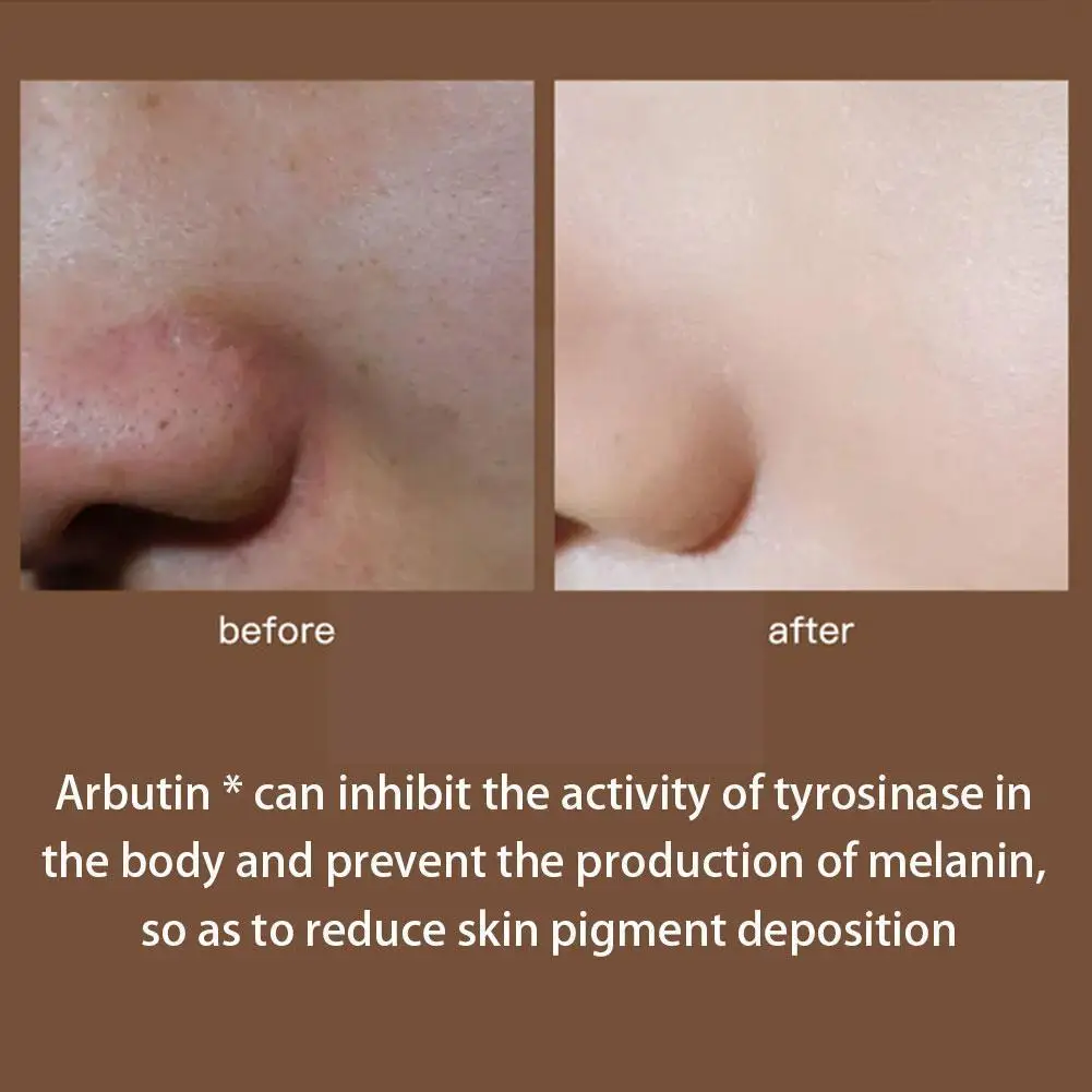

30ml Whitening Freckle Removing Essence For Women Hyaluronic Acid Stock Solution Pore Shrinking Serum Skin Care 4 Model I7p6