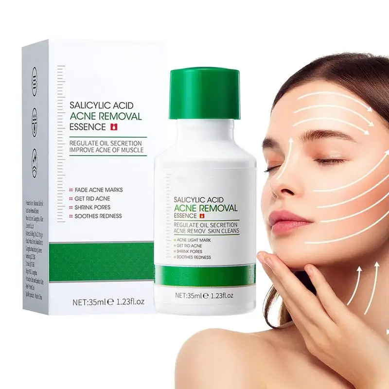 

Blemish Serums Acid Face Skin Repair Essence 35ml Anti Pimples Facial Serums Remove Blackheads Pimples Refine Pores Face Care