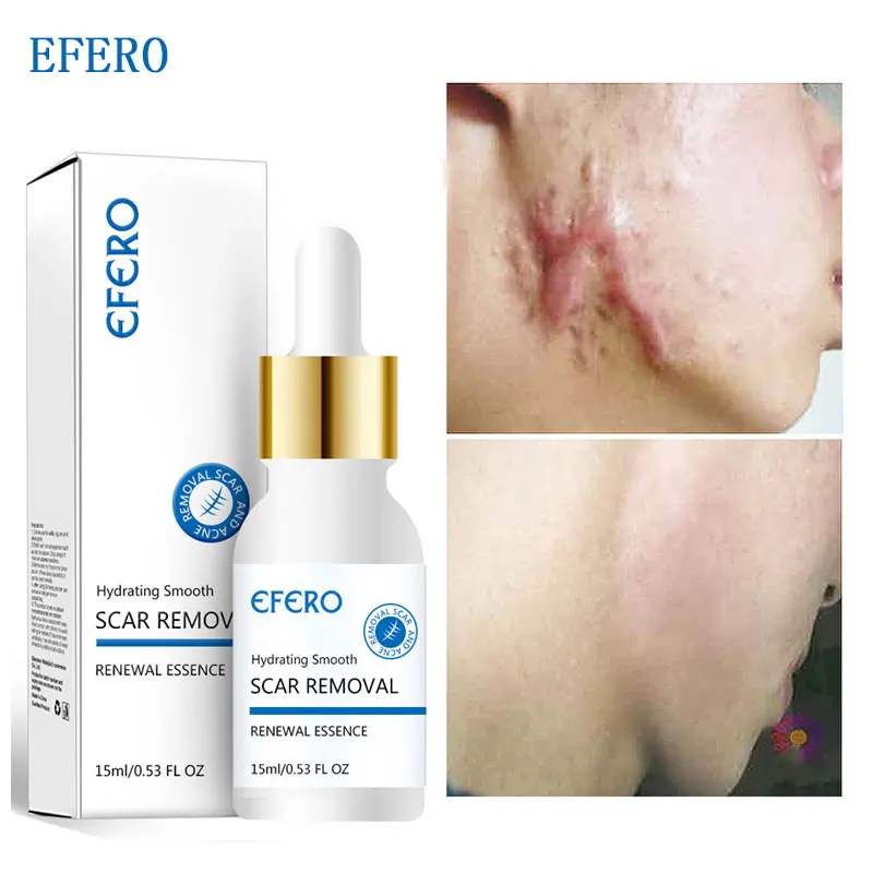 

Herbal Scar Removal Serum Stretch Marks Remove Acne Spots Burn Surgical Scars Treatment Whitening Moisturizing Beauty Skin Care
