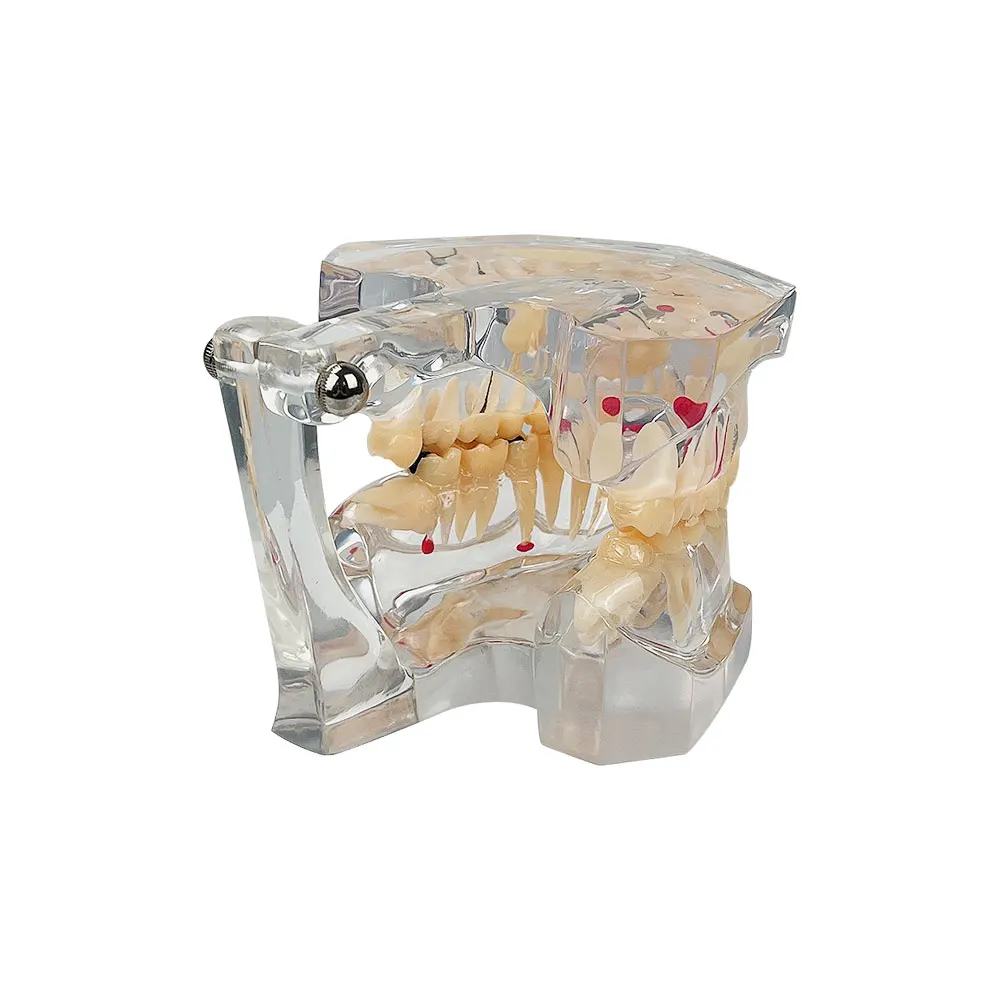 Модель зубов для стоматологической патологии 2 5 раза стоматология обучающая