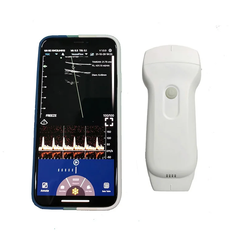 

LX-WP-C10RL Wireless Pregnancy Ultrasound Scanner USB Sonar Medical Other Ultrasonic & Electronic