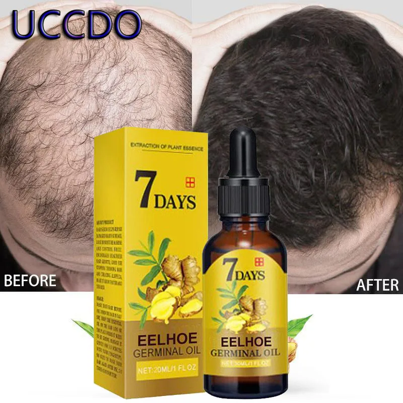 

Ginger Extract Anti Hair Loss Spray Natural Hair Care Serum Product Growth Prevention Hair Loss Treatment Hair Growth Liquid