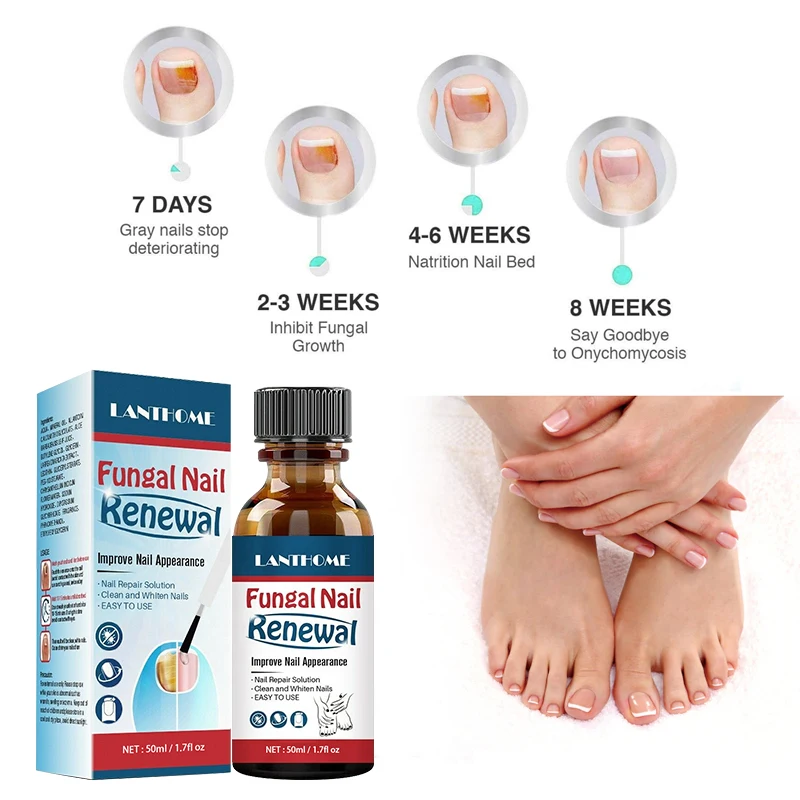 

Fungal Nail Treatment Serum Onychomycosis Paronychia Anti-Fungal Nail Infection Herbal Toe Fungus Foot Repair Essence Care 50ml