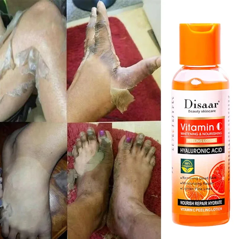 Желтый пилинг эритропия 100% органическое отбеливание темная кожа отшелушивающий