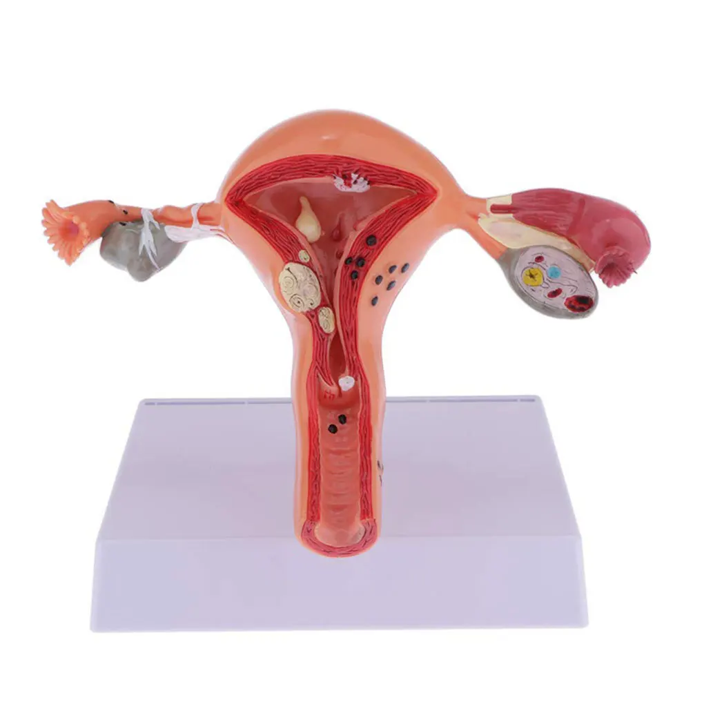 

Female Fake Uterus Structure Studying Model Teachers Educational Teaching Aid Display Experiment Accessory School