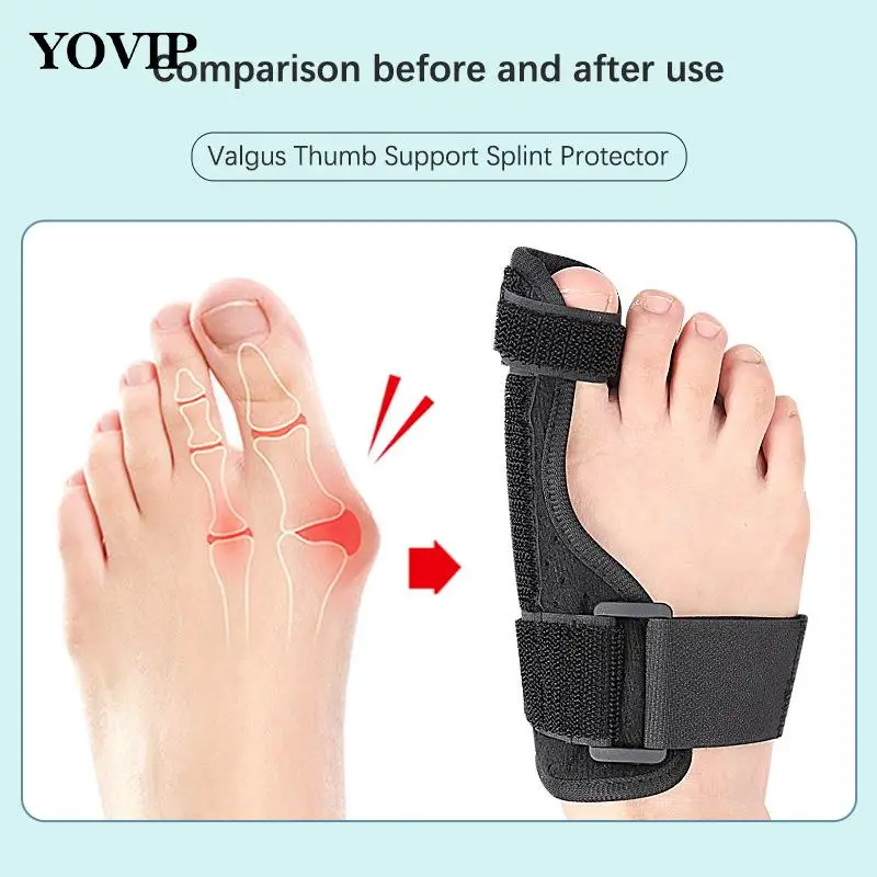 

1Pcs Foot Care Pedicure Orthotics Soft Bunion Corrector Toe Separator Splint Correction System Medical Device Hallux Valgus
