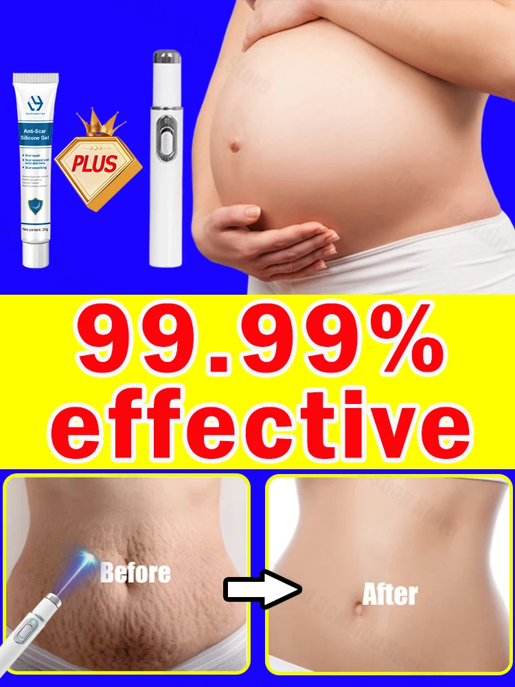 Послеродовые следы крема Vergetures élimine les Brands rouges et blanches