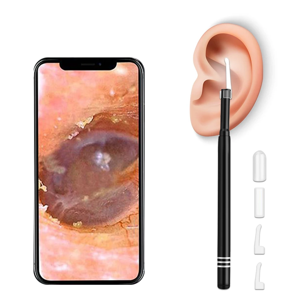 

Smart Visual Ear Cleaner Ear Stick Endoscope Earpick Camera Otoscope Ear Cleaner Ear Wax Remover Ear Picker Earwax Removal Tool